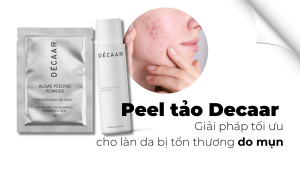 Peel tảo Decaar & Giải pháp tối ưu cho làn da bị tổn thương do mụn (banner bài viết)