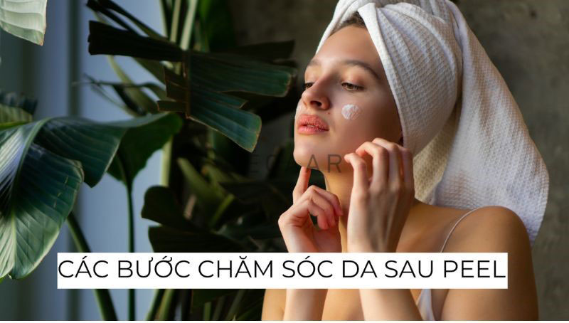 Chăm Da Đúng Cách Sau Peel