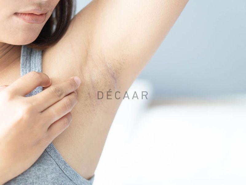 lợi ích vượt trội của peel nách retinol