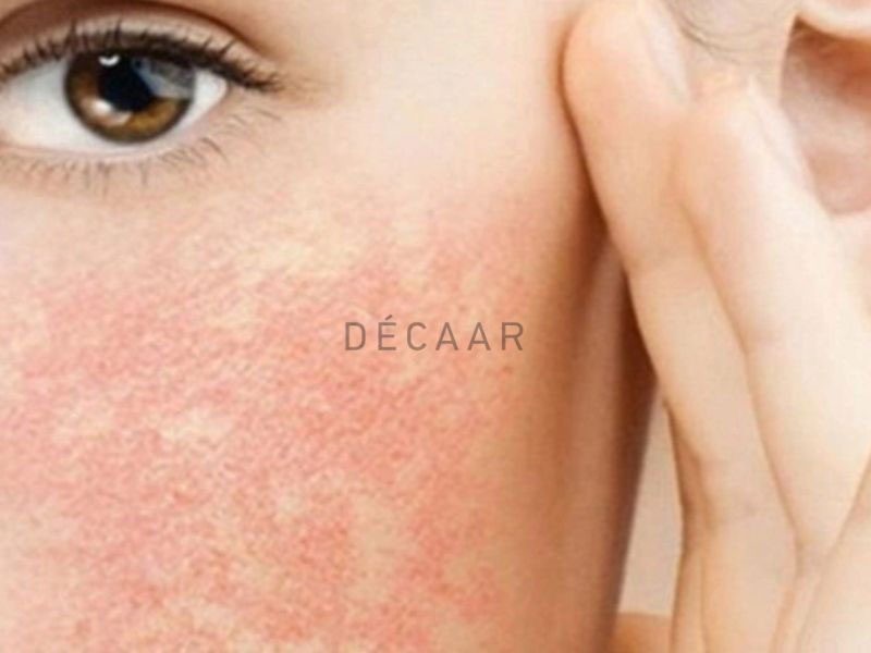 Tai hại khi peel da quá sớm
