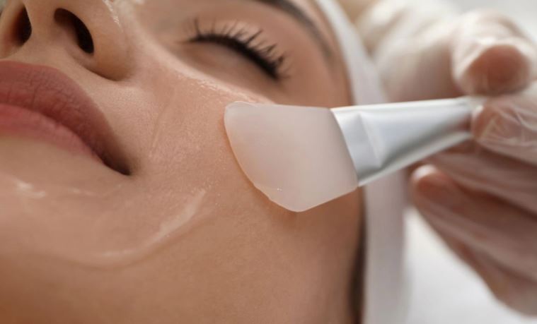 Quy trình peel da trị sẹo rỗ tiêu chuẩn