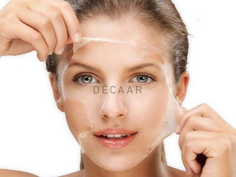peel da trong điều trị sẹo rỗ