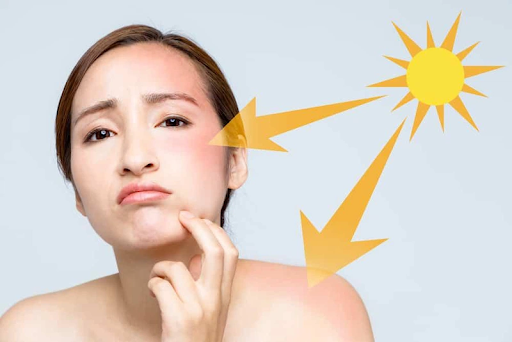 Bỏ quên chống nắng vì trời không có nắng