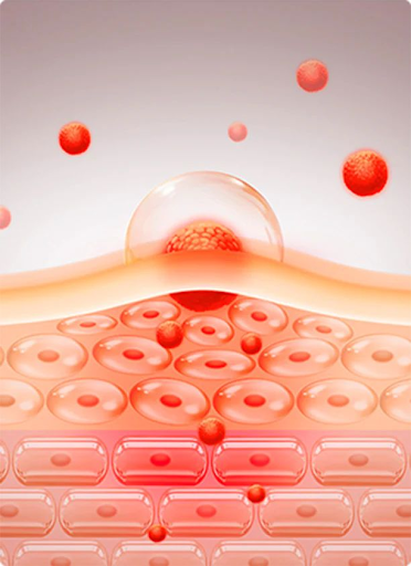 Peel da khi hàng rào bảo vệ đang yếu