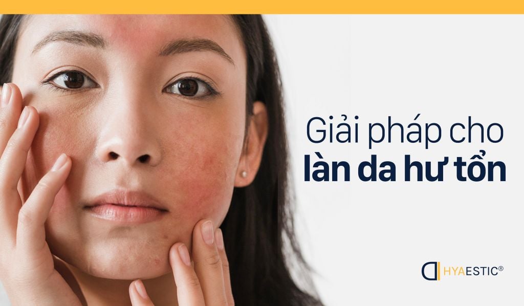 SERUM PHỤC HỒI DA TỔN THƯƠNG