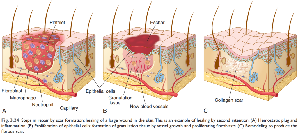 Cơ Chế Hình Thành Sẹo