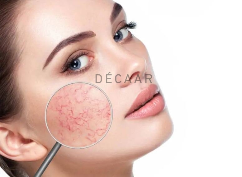 Hình: Da yếu có làm sáng được không