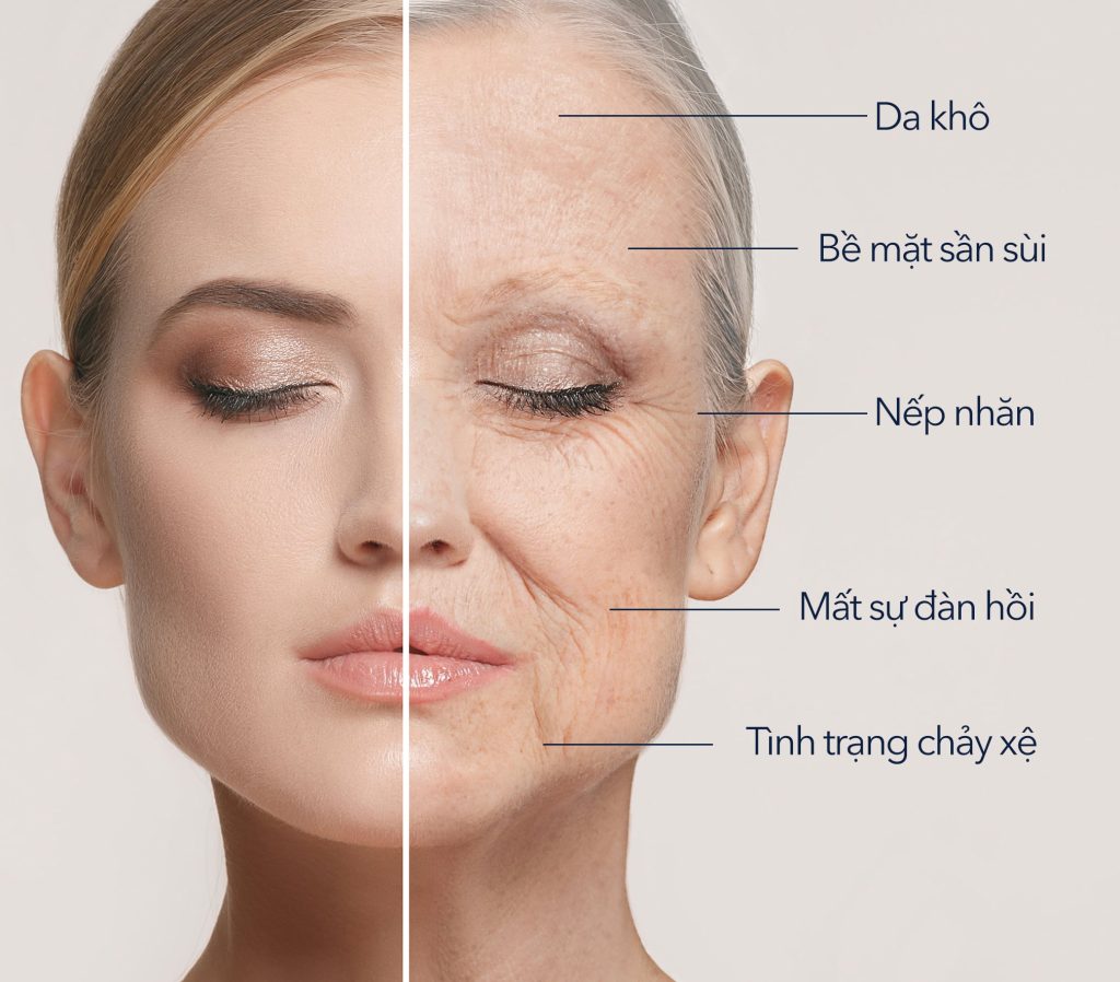 Hình: Da phụ nữ bị lão hóa theo thời gian