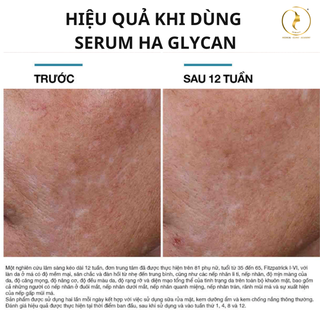 Hình: Trước và sau khi sử dụng 