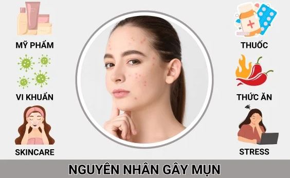 Hình: Nguyên nhân làm da bị mụn