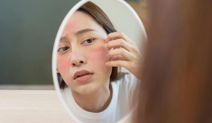 Hình: Dấu hiệu nhạy cảm khi da đang giao mùa