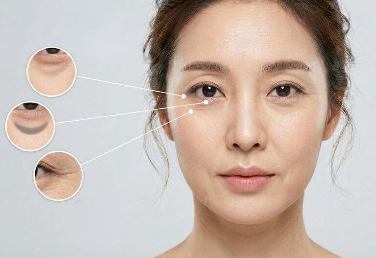 Hình: Công dụng của Mesoestetic Mesofiller periocular