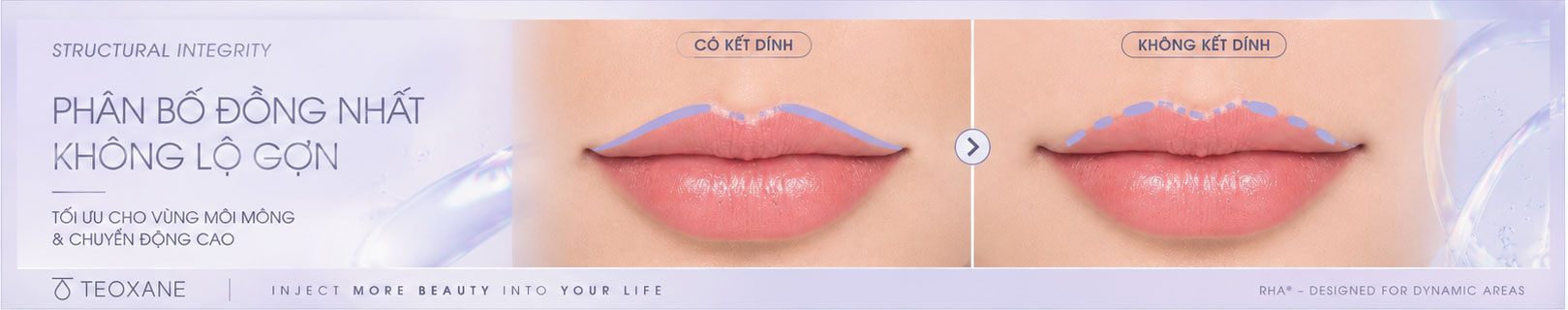 Hình: Độ kết dính của Teoxane RHA