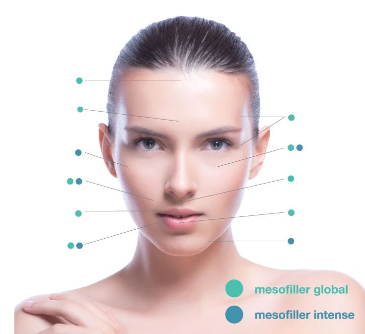 Hình: So sánh mesofiller global của Mesoestetic và Mesofiller intense