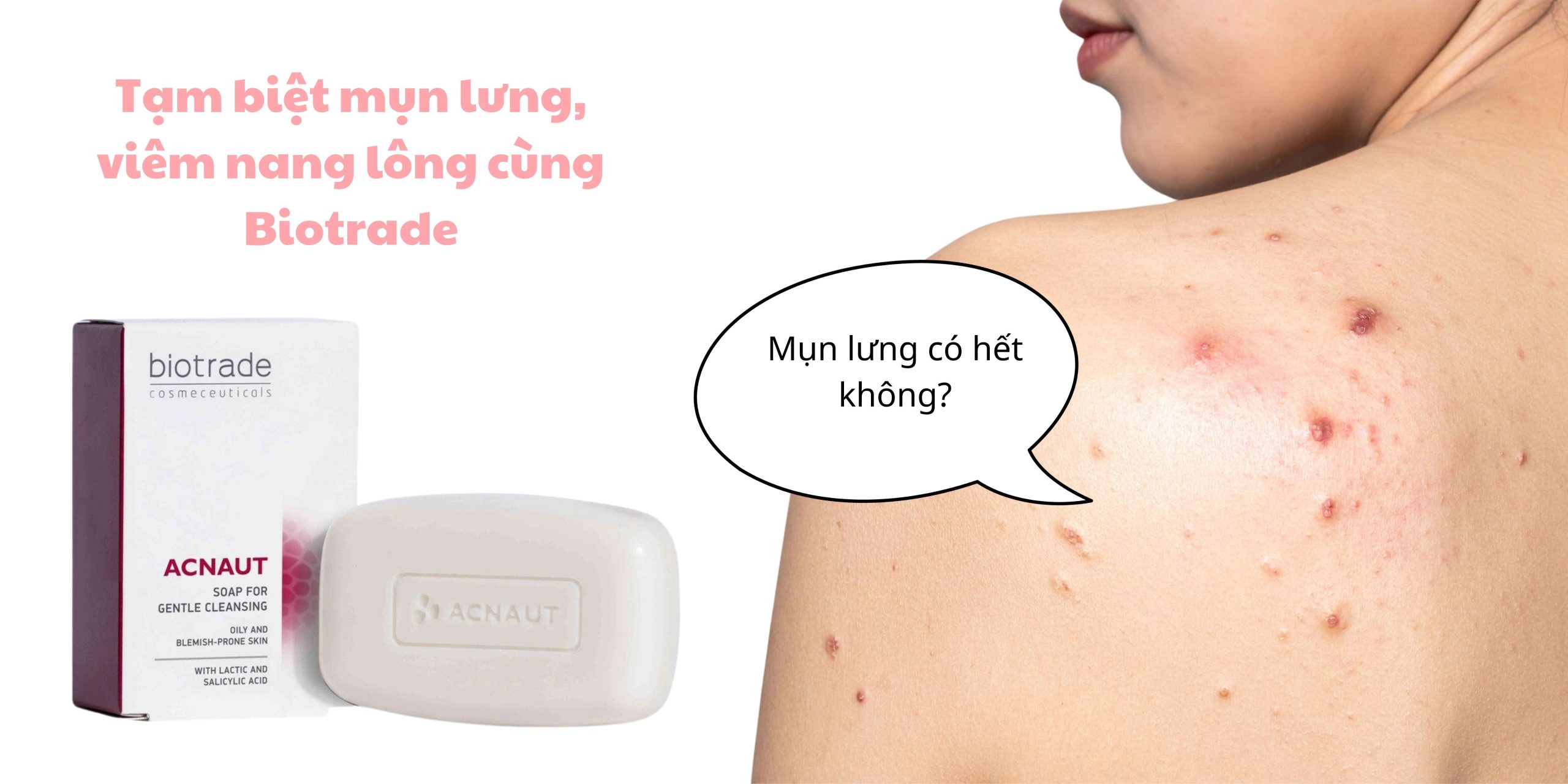 Biotrade Acnaut Soap